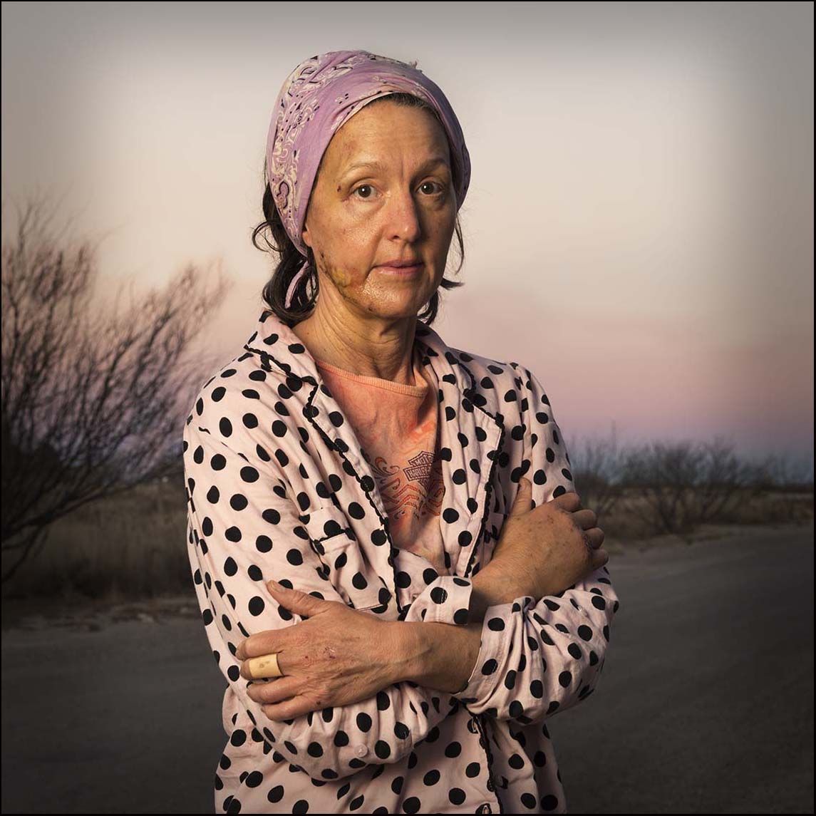 Marci after her bike wreck_© James H. Evans